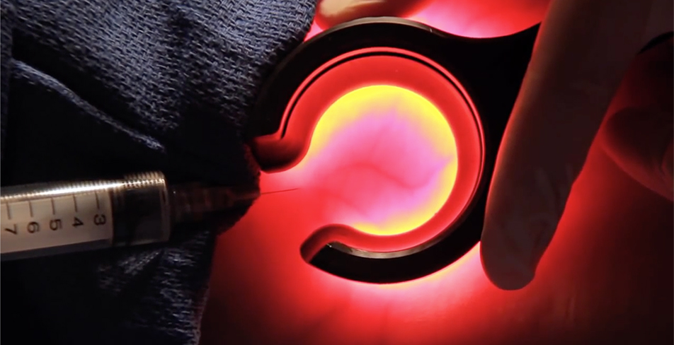 Veinlite Ledx, Devlet Malzeme Ofisi, DMO, Damar Saptayıcı, Damar Saptama Cihazı, Damar Görüntüleme Cihazı, Damar Bulma Cihazı